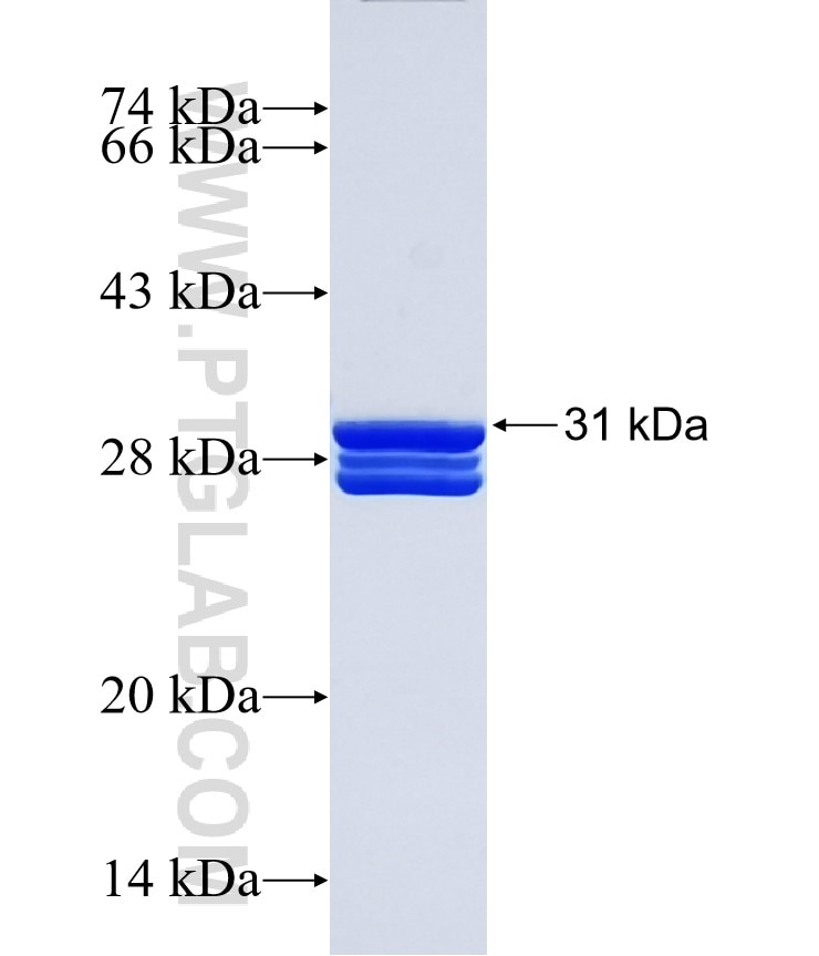 ALDH1A1 fusion protein Ag17358 SDS-PAGE