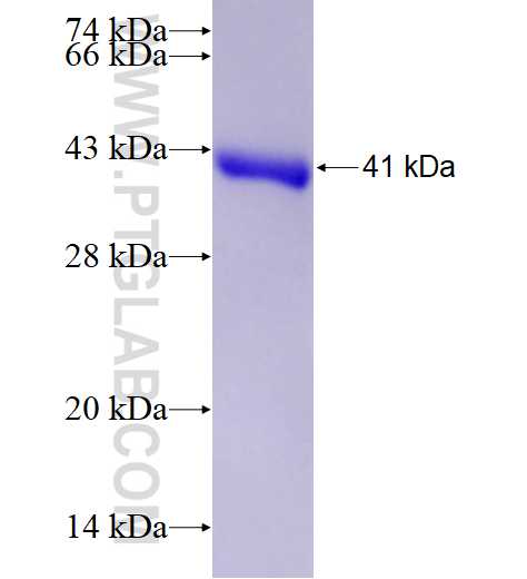 ALDH1A1 fusion protein Ag8551 SDS-PAGE
