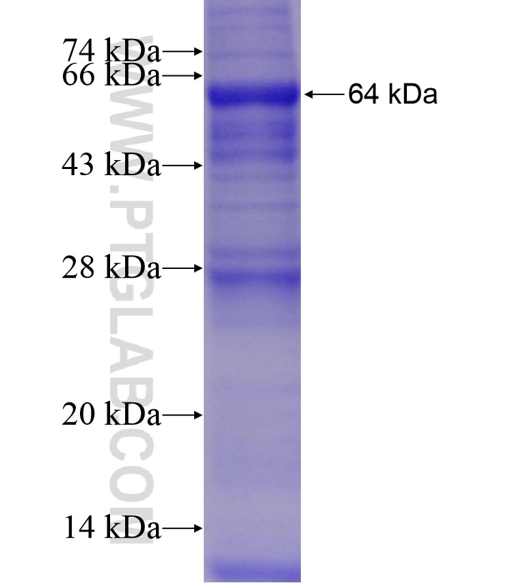 ALDH1A1 fusion protein Ag8665 SDS-PAGE