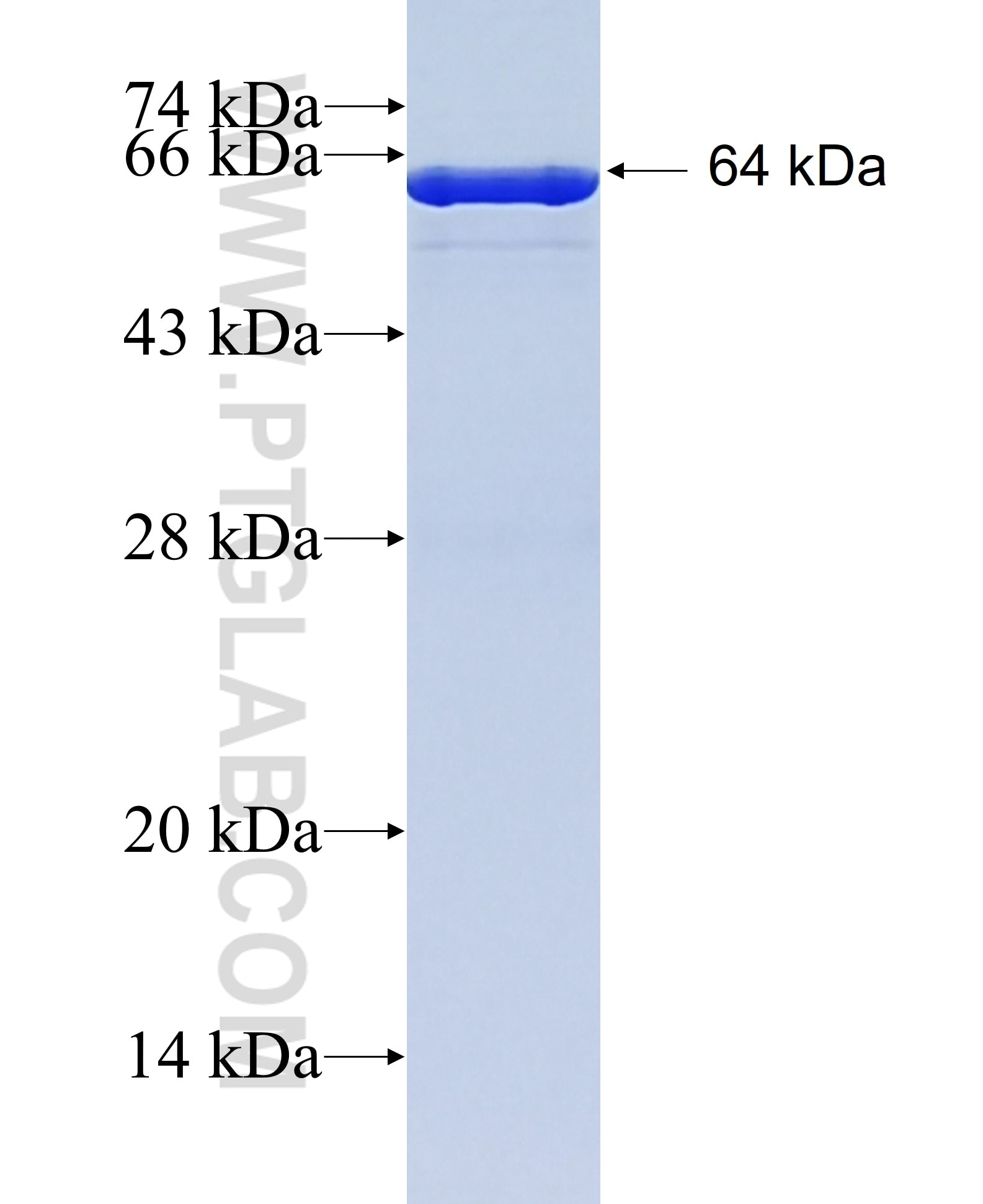 ALDH1A1 fusion protein Ag8665 SDS-PAGE