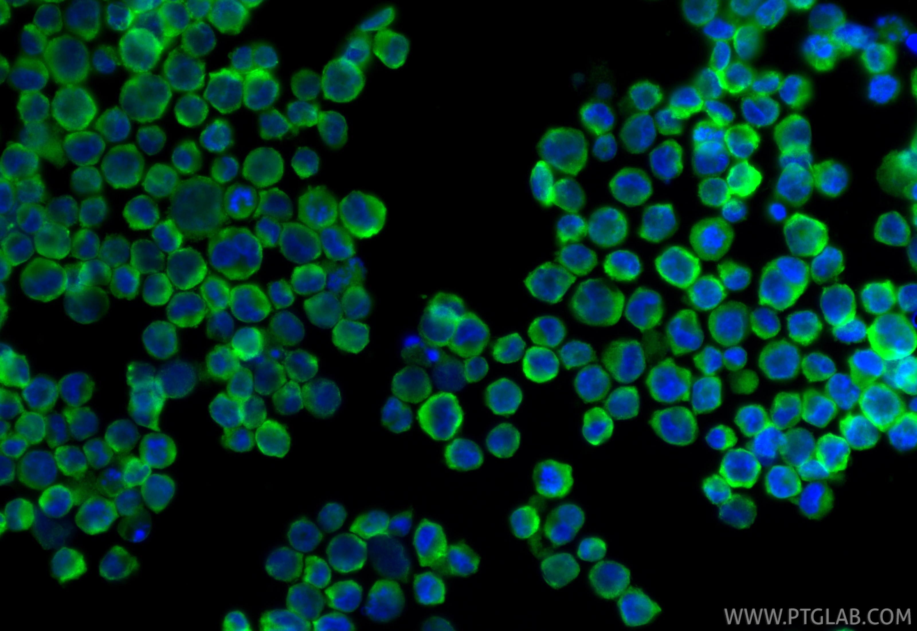 Immunofluorescence (IF) / fluorescent staining of K-562 cells using ALDH1A2 Polyclonal antibody (13951-1-AP)