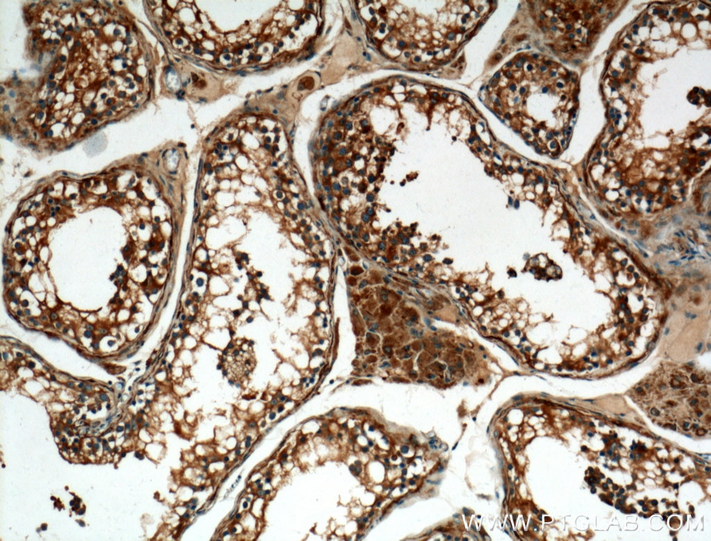 Immunohistochemistry (IHC) staining of human testis tissue using ALDH1A2 Polyclonal antibody (13951-1-AP)