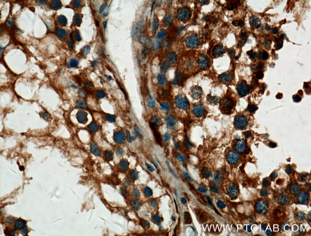 Immunohistochemistry (IHC) staining of human testis tissue using ALDH1A2 Polyclonal antibody (13951-1-AP)