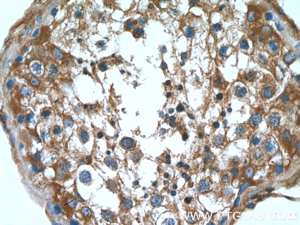 Immunohistochemistry (IHC) staining of human testis tissue using ALDH1A2 Polyclonal antibody (13951-1-AP)