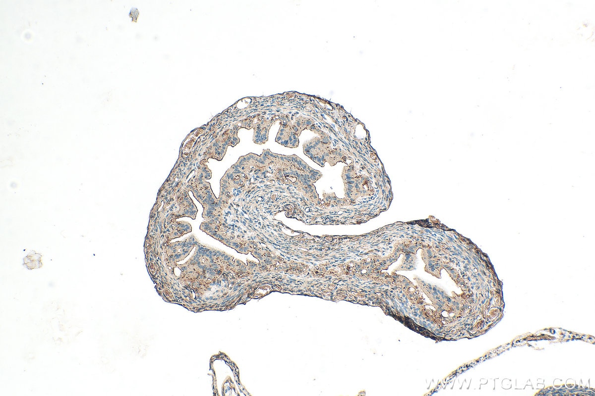 Immunohistochemistry (IHC) staining of mouse ovary tissue using ALDH1A2 Polyclonal antibody (13951-1-AP)