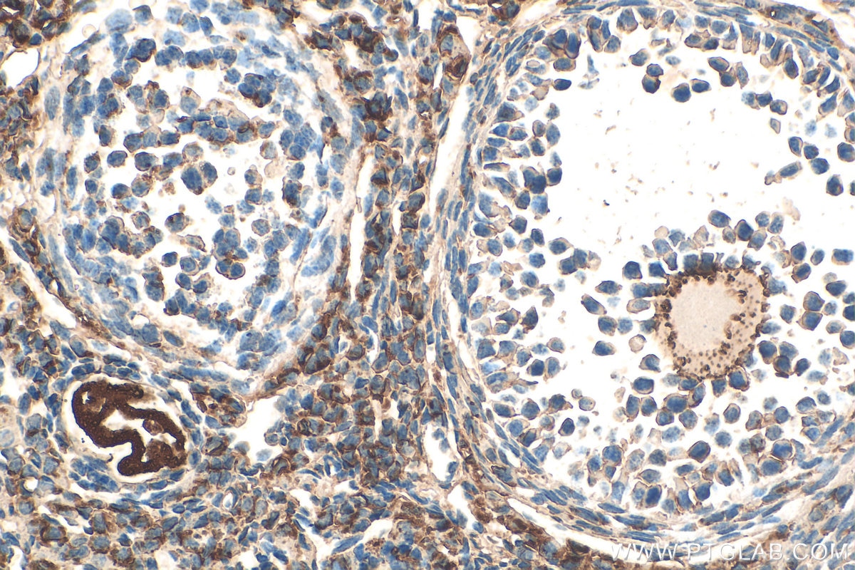 Immunohistochemistry (IHC) staining of mouse ovary tissue using ALDH1A2 Polyclonal antibody (13951-1-AP)