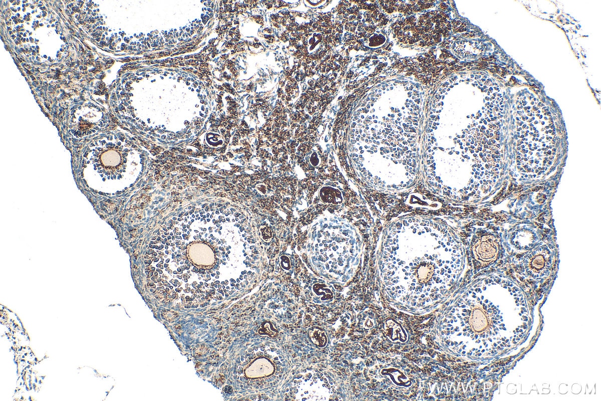 Immunohistochemistry (IHC) staining of mouse ovary tissue using ALDH1A2 Polyclonal antibody (13951-1-AP)