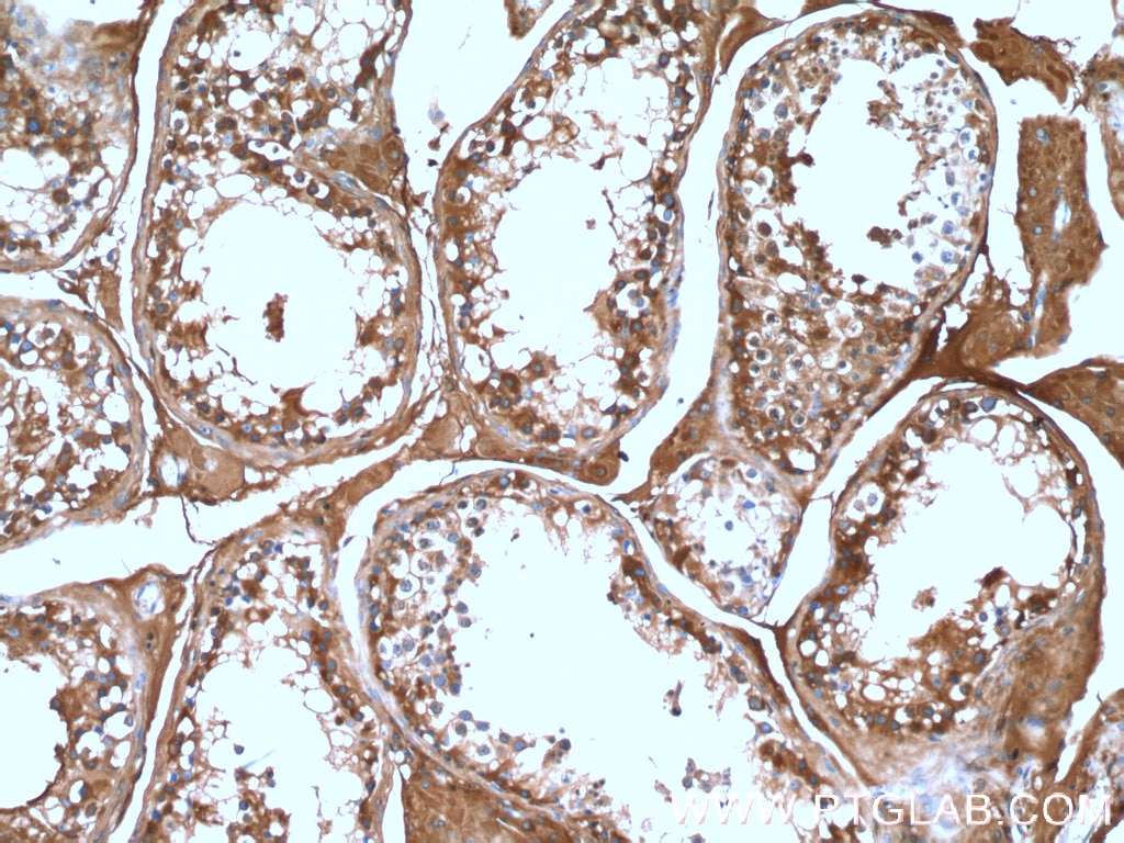 Immunohistochemistry (IHC) staining of human testis tissue using ALDH1A2 Polyclonal antibody (13951-1-AP)