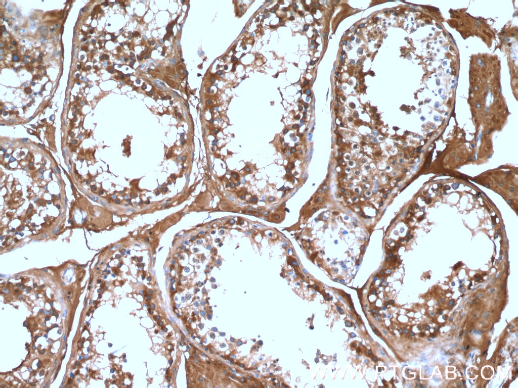 IHC staining of human testis using 13951-1-AP