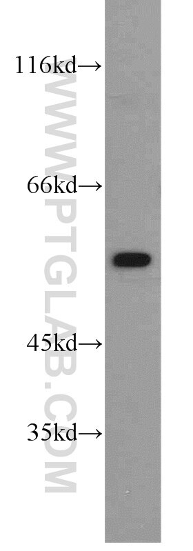 Western Blot (WB) analysis of K-562 cells using ALDH1A2 Polyclonal antibody (13951-1-AP)