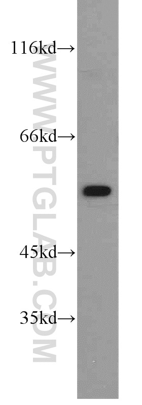 Western Blot (WB) analysis of K-562 cells using ALDH1A2 Polyclonal antibody (13951-1-AP)