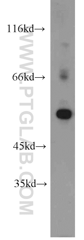 Western Blot (WB) analysis of K-562 cells using ALDH1A2 Polyclonal antibody (13951-1-AP)