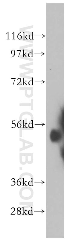 Western Blot (WB) analysis of mouse testis tissue using ALDH1A2 Polyclonal antibody (13951-1-AP)