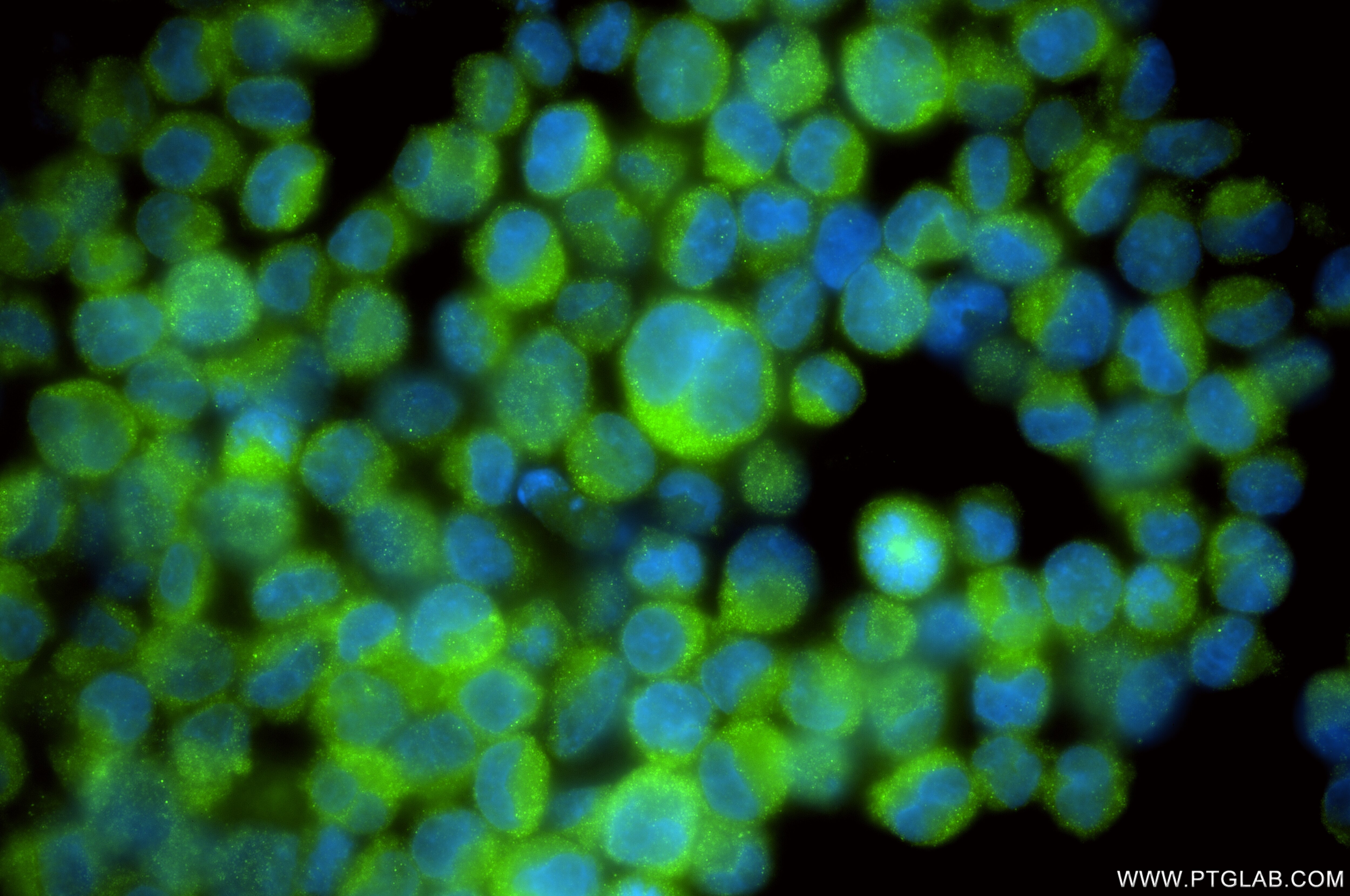 Immunofluorescence (IF) / fluorescent staining of K-562 cells using ALDH1A2 Recombinant antibody (86518-1-RR)