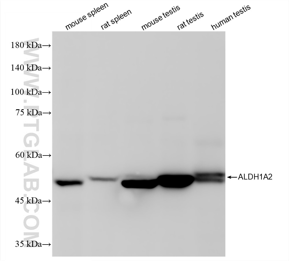 Western Blot (WB) analysis of various lysates using ALDH1A2 Recombinant antibody (86518-1-RR)