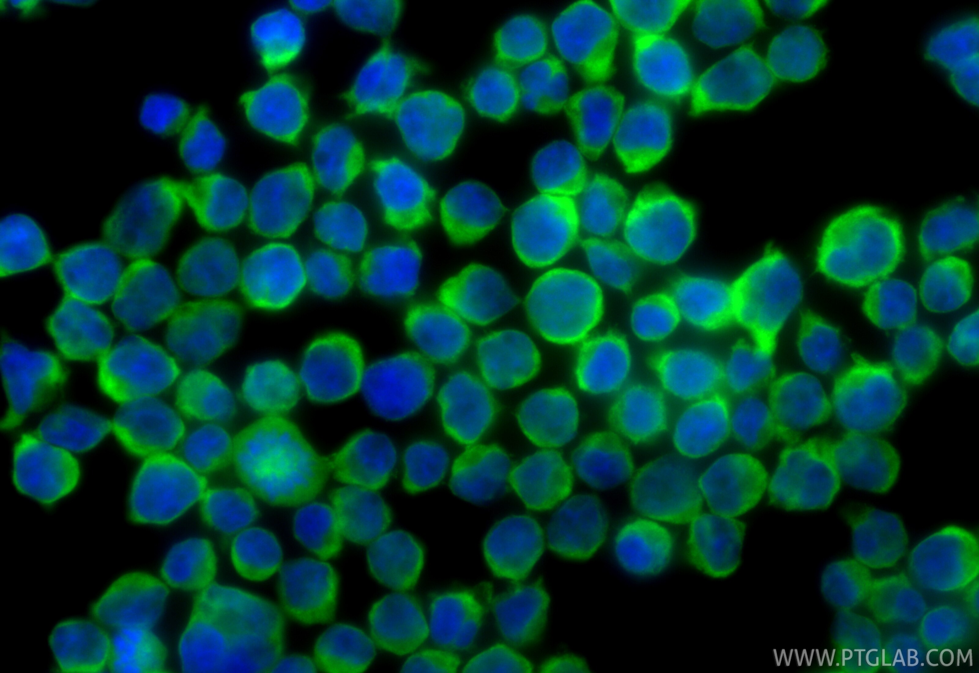 Immunofluorescence (IF) / fluorescent staining of Jurkat cells using CoraLite® Plus 488-conjugated ALDH1A2 Recombinant  (CL488-86518)