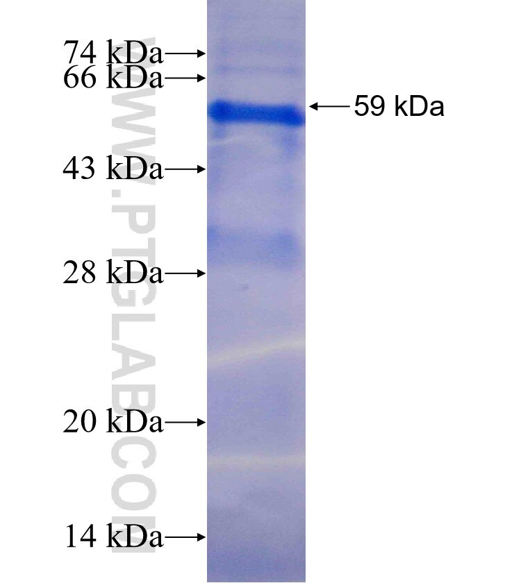 ALDH1A2 fusion protein Ag5062 SDS-PAGE