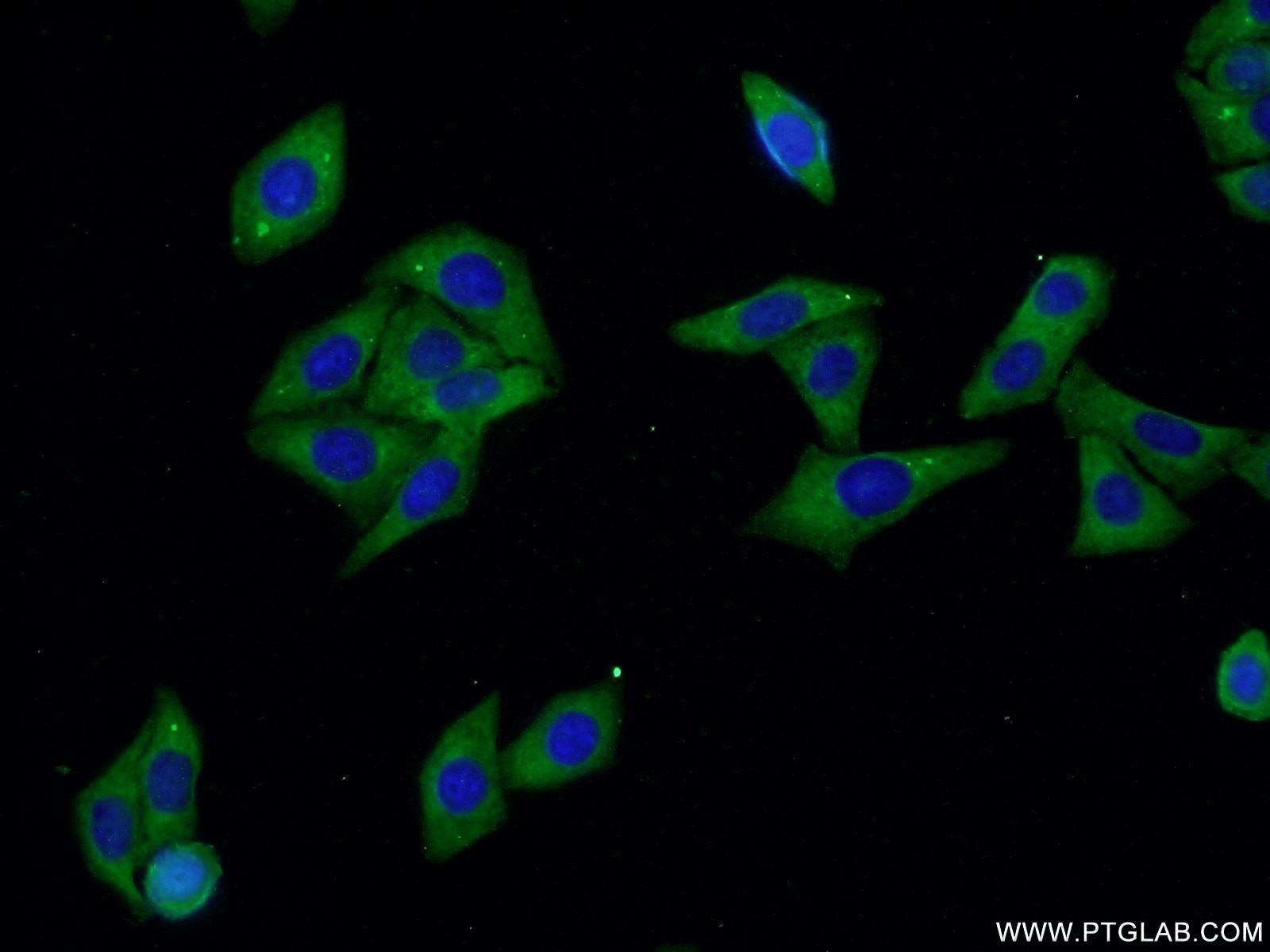 Immunofluorescence (IF) / fluorescent staining of HepG2 cells using ALDH1A3 Polyclonal antibody (25167-1-AP)