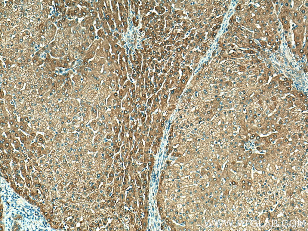 Immunohistochemistry (IHC) staining of human liver tissue using ALDH1A3 Polyclonal antibody (25167-1-AP)