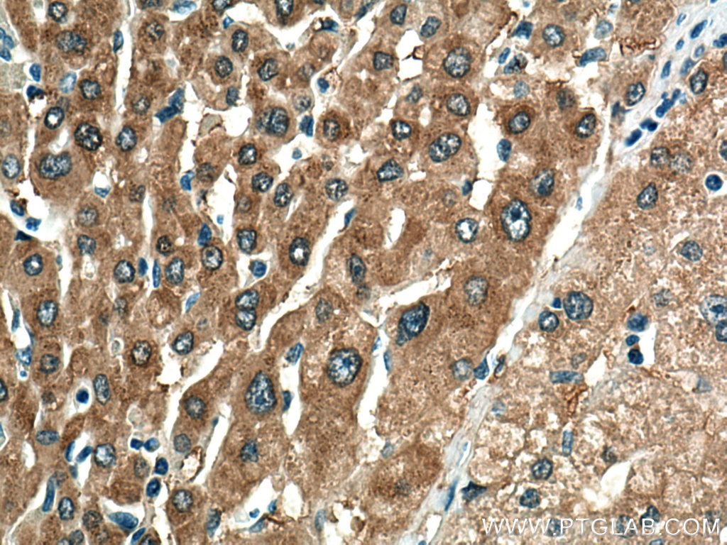 Immunohistochemistry (IHC) staining of human liver tissue using ALDH1A3 Polyclonal antibody (25167-1-AP)