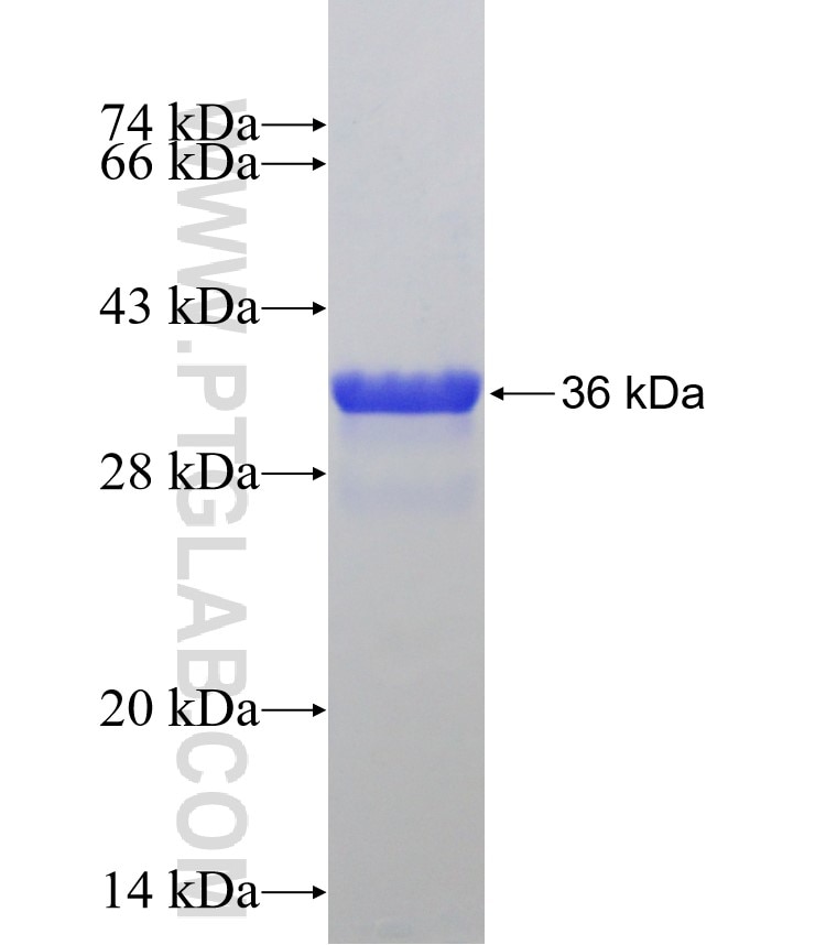 ALDH1A3 fusion protein Ag31100 SDS-PAGE