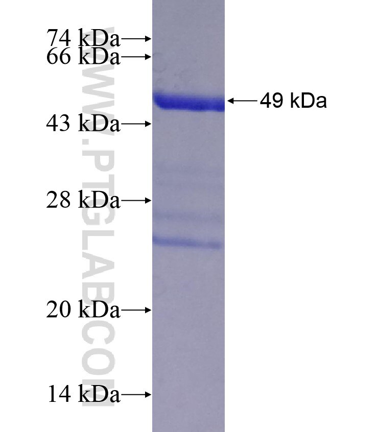 ALDH1A3 fusion protein Ag18311 SDS-PAGE