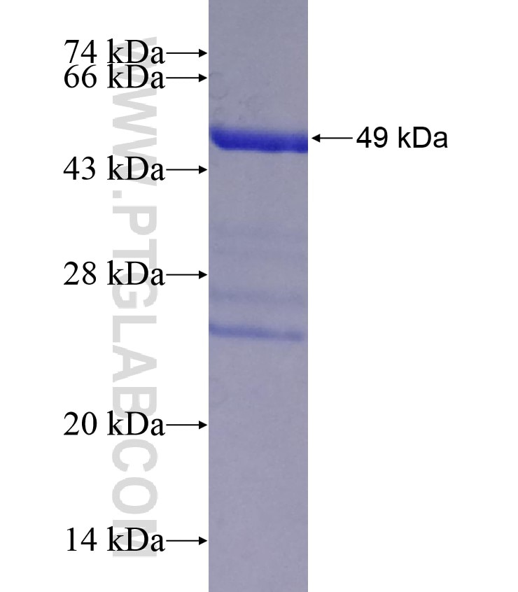 ALDH1A3 fusion protein Ag18311 SDS-PAGE