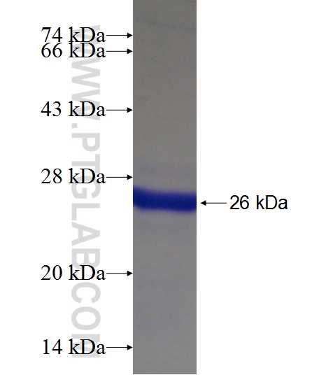 ALDH1A3 fusion protein Ag18605 SDS-PAGE