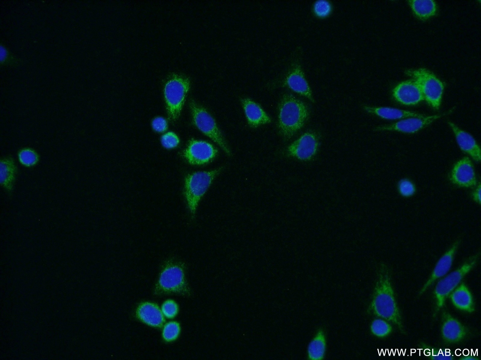Immunofluorescence (IF) / fluorescent staining of HepG2 cells using ALDH1B1 Polyclonal antibody (15560-1-AP)