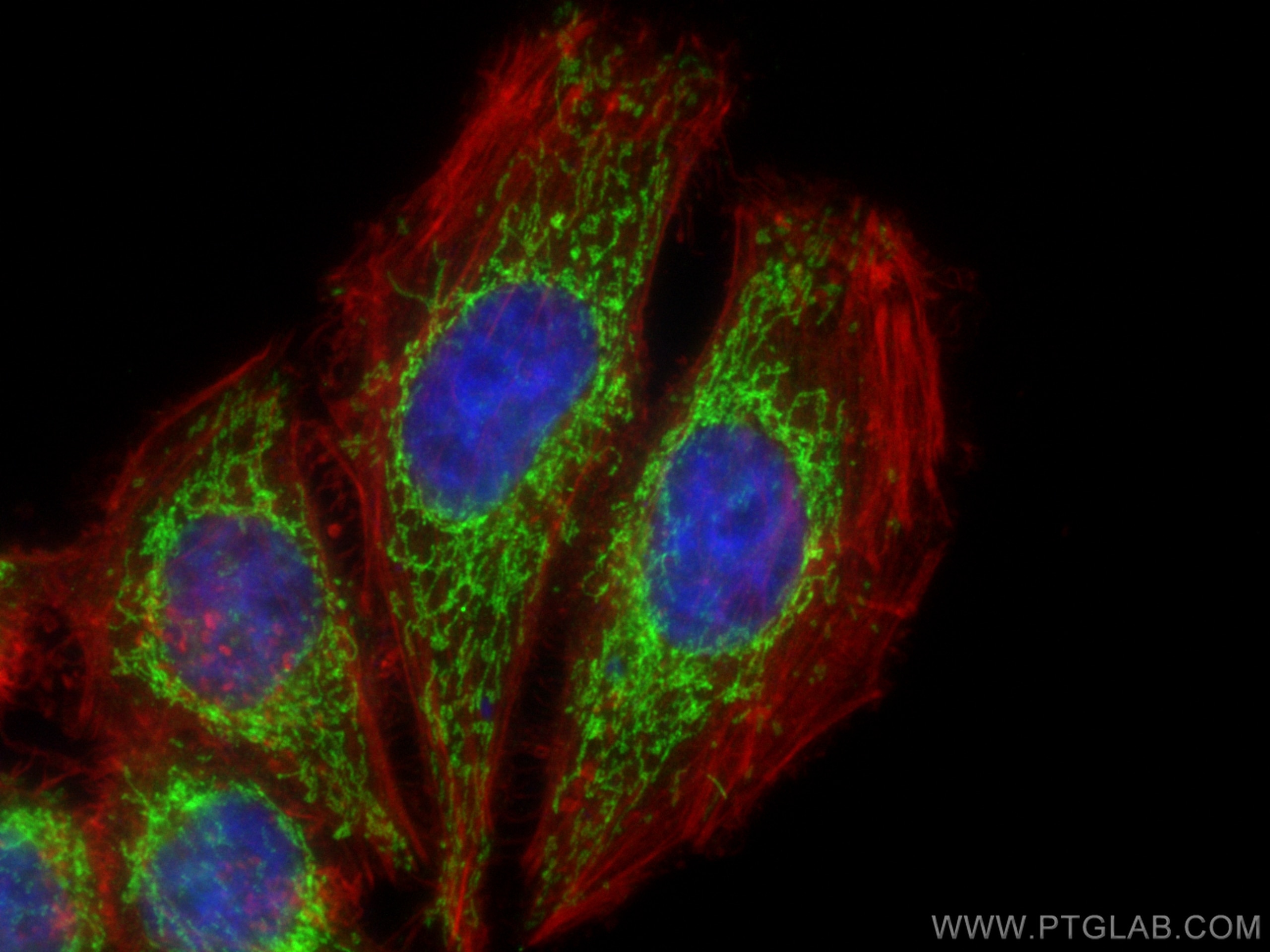 Immunofluorescence (IF) / fluorescent staining of HepG2 cells using ALDH1B1 Polyclonal antibody (15560-1-AP)