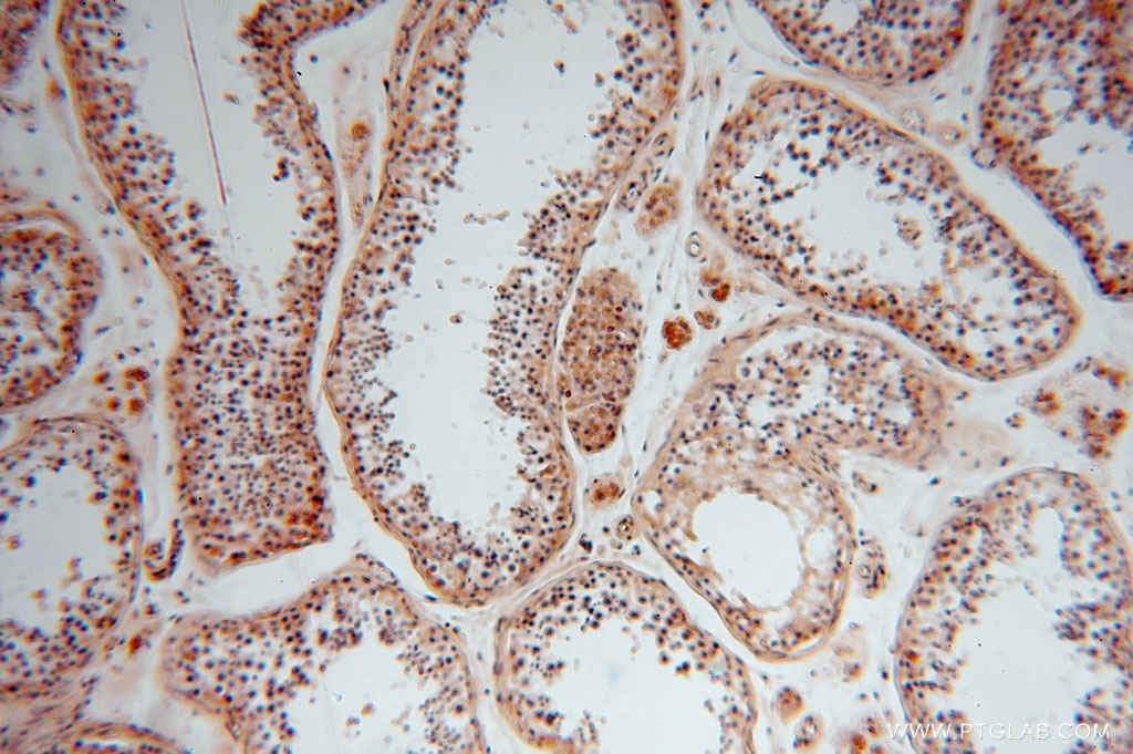 Immunohistochemistry (IHC) staining of human testis tissue using ALDH1B1 Polyclonal antibody (15560-1-AP)