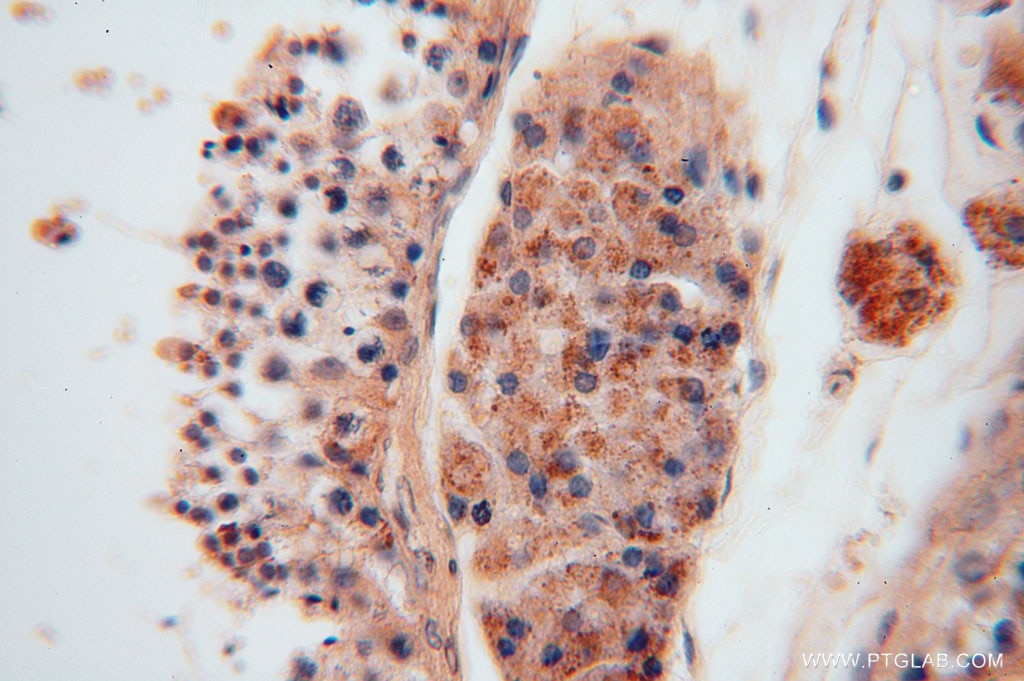 Immunohistochemistry (IHC) staining of human testis tissue using ALDH1B1 Polyclonal antibody (15560-1-AP)