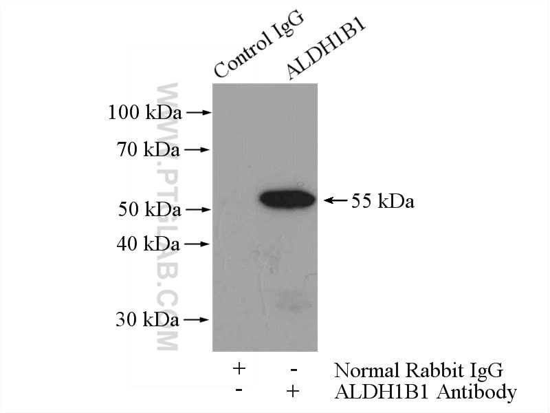 Immunoprecipitation (IP) experiment of mouse brain tissue using ALDH1B1 Polyclonal antibody (15560-1-AP)