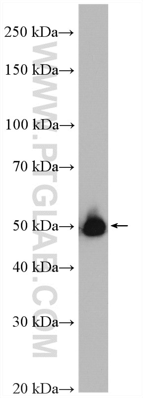 Western Blot (WB) analysis of K-562 cells using ALDH1B1 Polyclonal antibody (15560-1-AP)