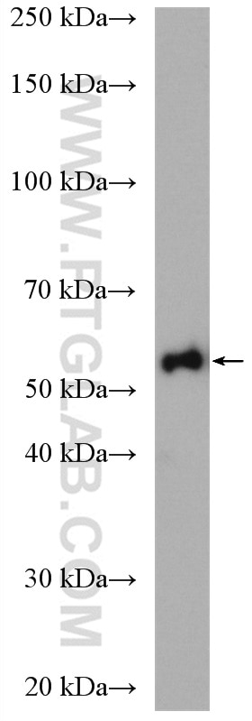 Western Blot (WB) analysis of HepG2 cells using ALDH1B1 Polyclonal antibody (15560-1-AP)