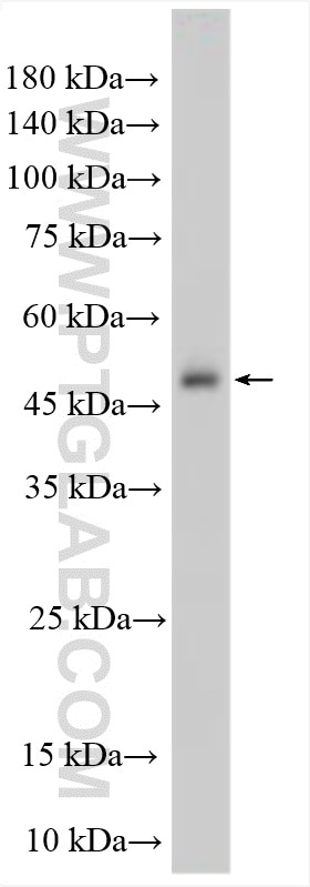 Western Blot (WB) analysis of K-562 cells using ALDH1B1 Polyclonal antibody (15560-1-AP)