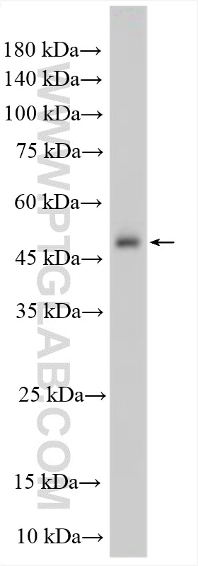 WB analysis of K-562 using 15560-1-AP