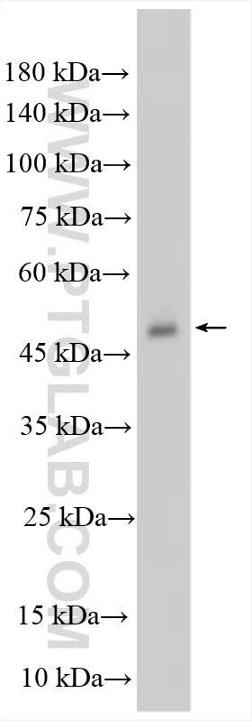 Western Blot (WB) analysis of HepG2 cells using ALDH1B1 Polyclonal antibody (15560-1-AP)