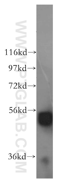 Western Blot (WB) analysis of mouse brain tissue using ALDH1B1 Polyclonal antibody (15560-1-AP)