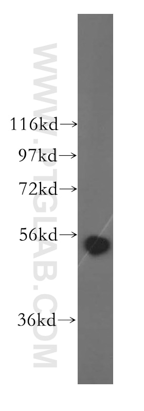 Western Blot (WB) analysis of HepG2 cells using ALDH1B1 Polyclonal antibody (15560-1-AP)