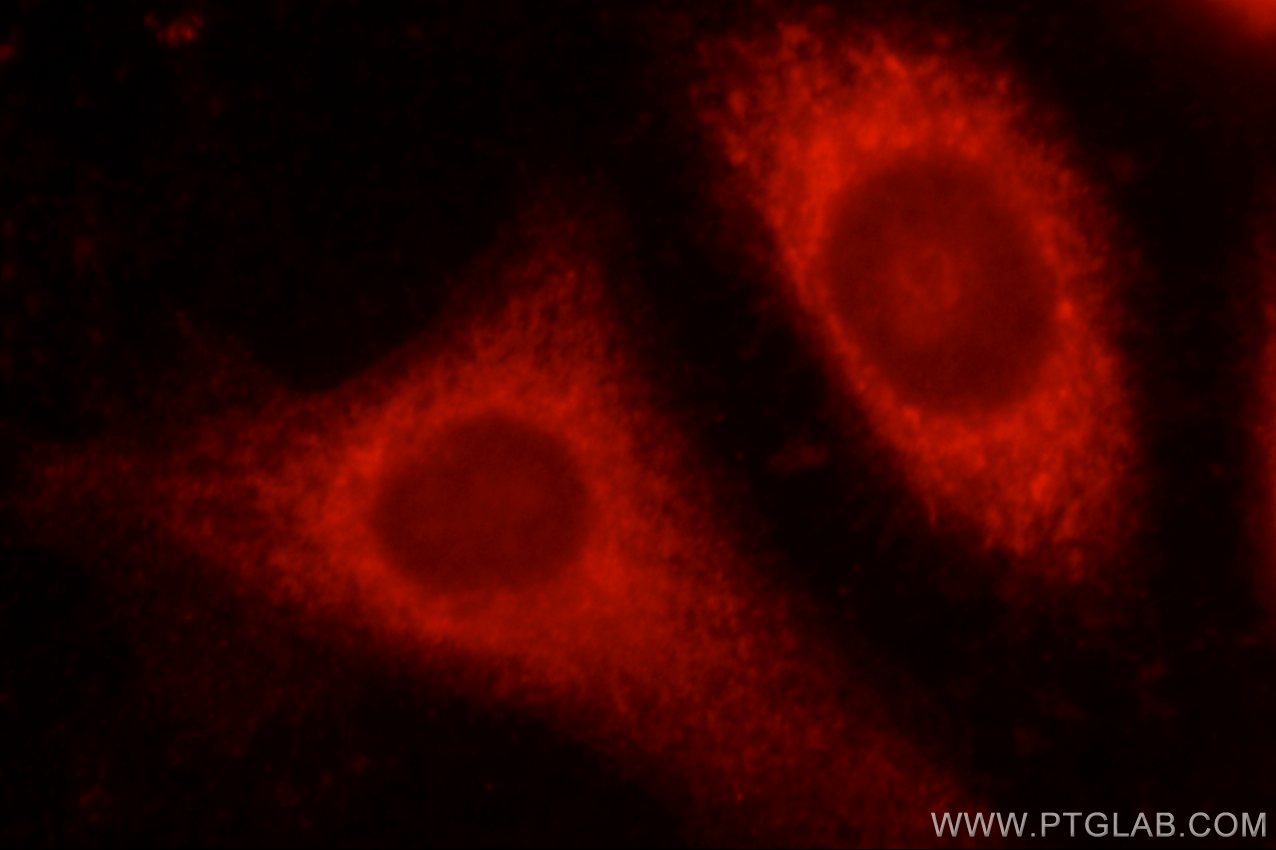 Immunofluorescence (IF) / fluorescent staining of MCF-7 cells using ALDH1B1 Polyclonal antibody (22220-1-AP)