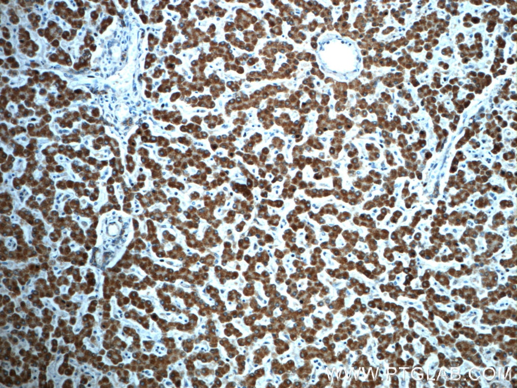 Immunohistochemistry (IHC) staining of human liver tissue using ALDH1B1 Polyclonal antibody (22220-1-AP)