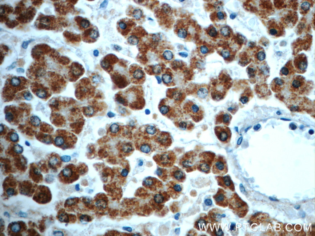 Immunohistochemistry (IHC) staining of human liver tissue using ALDH1B1 Polyclonal antibody (22220-1-AP)