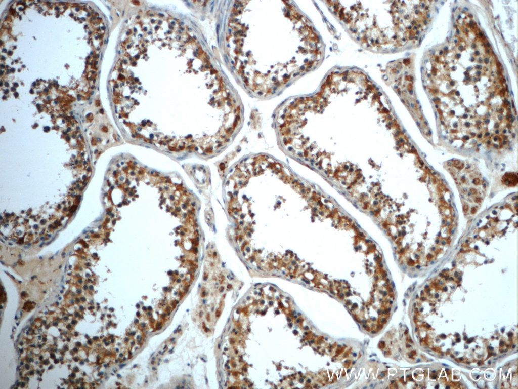 Immunohistochemistry (IHC) staining of human testis tissue using ALDH1B1 Polyclonal antibody (22220-1-AP)