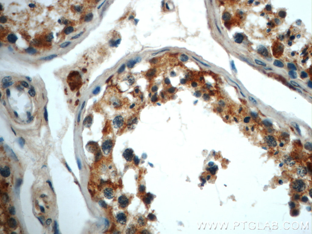 Immunohistochemistry (IHC) staining of human testis tissue using ALDH1B1 Polyclonal antibody (22220-1-AP)