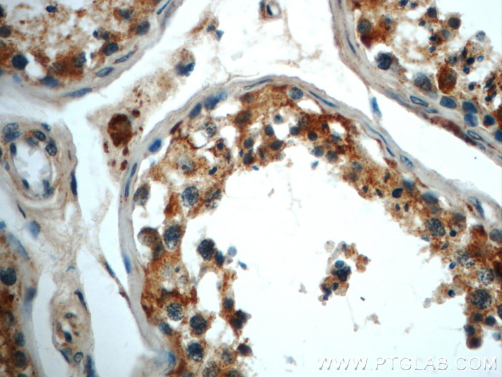 IHC staining of human testis using 22220-1-AP