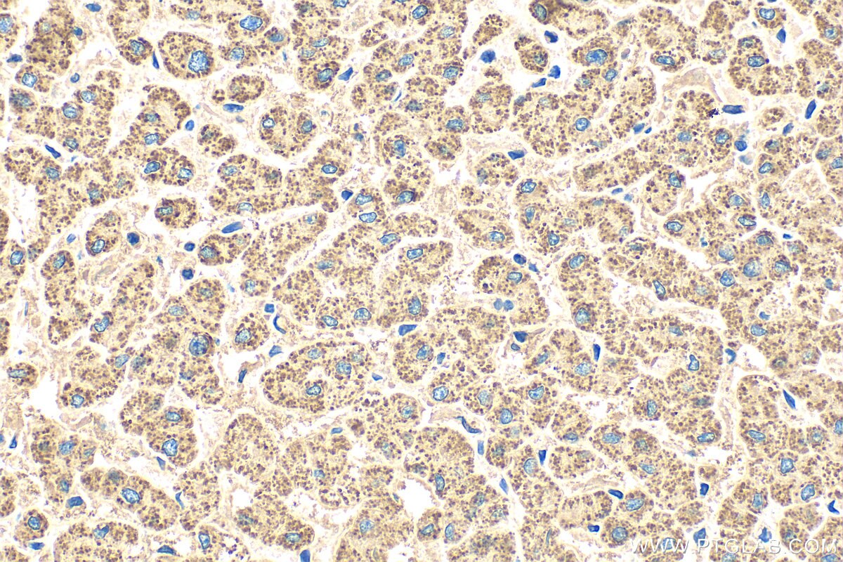 Immunohistochemistry (IHC) staining of human liver tissue using ALDH1B1 Polyclonal antibody (22220-1-AP)