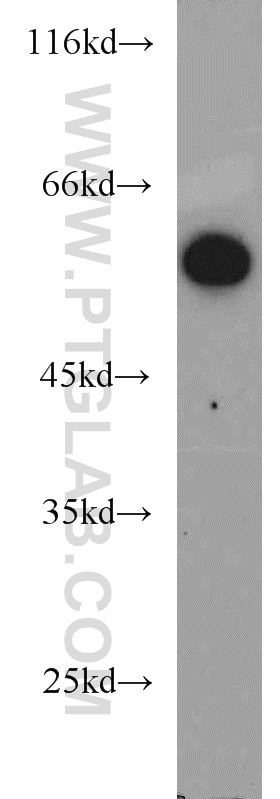 Western Blot (WB) analysis of HeLa cells using ALDH1B1 Polyclonal antibody (22220-1-AP)