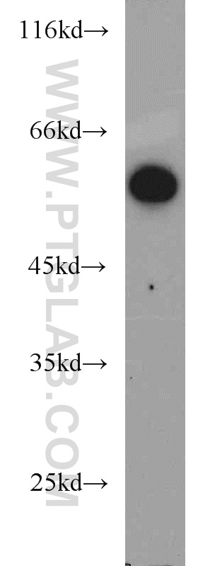 WB analysis of HeLa using 22220-1-AP