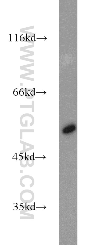 Western Blot (WB) analysis of mouse brain tissue using ALDH1B1 Polyclonal antibody (22220-1-AP)